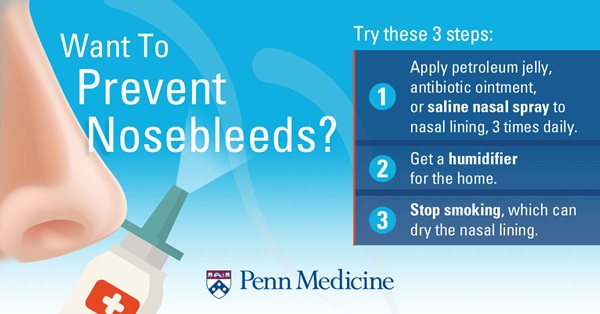 how_to_prevent_nosebleeds